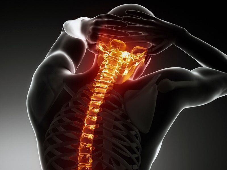 Príznaky osteochondrózy