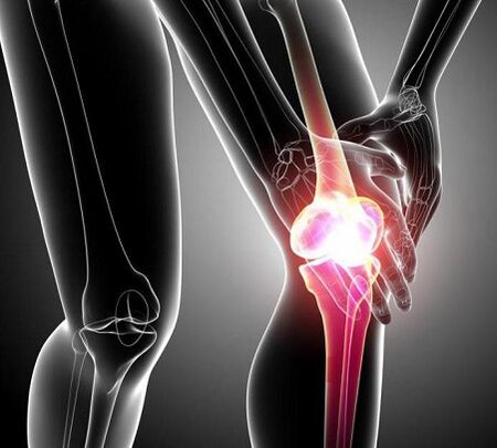 poškodenie kolenného kĺbu s artritídou a artrózou