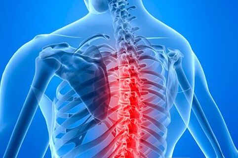 lézia chrbtice v prípade hrudnej osteochondrózy
