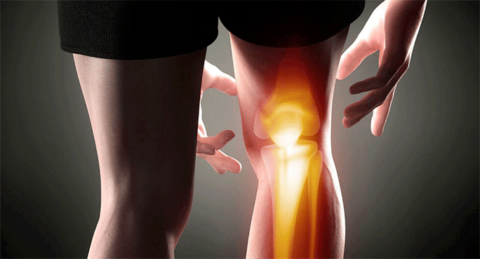 bolesť kolenného kĺbu
