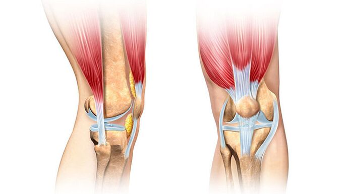 kolenný kĺb a jeho liečba bolesti