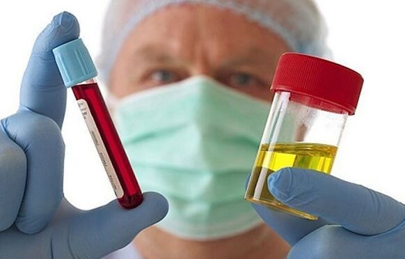 Spôsoby diagnostikovania osteochondrózy krčnej chrbtice