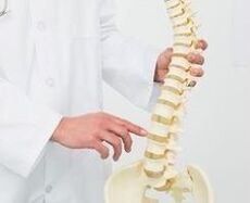 bedrová osteochondróza