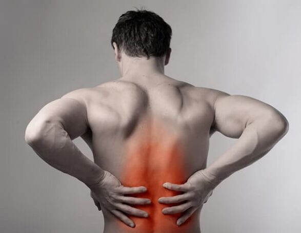 bolesť chrbta v dôsledku osteochondrózy chrbtice